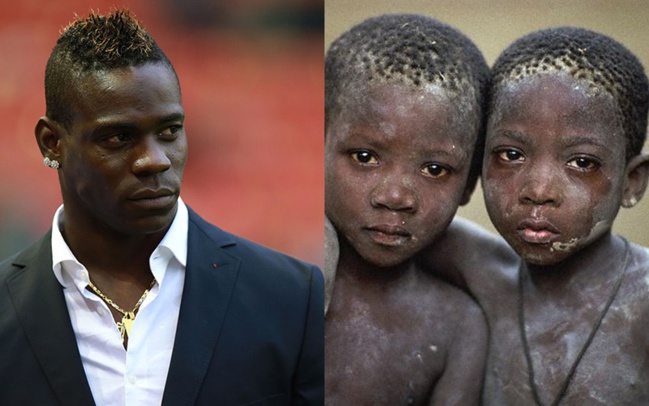 Mario Balotelli donne la moitié de son salaire aux enfants d’Afrique