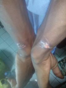 Aioun : Corruption, esclavage et torture Aioun : Corruption, esclavage et torture