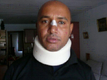 Un mauritanien brutalise par la police espagnole : Les syndicats se mobilisent et portent plainte