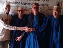 Journée internationale de sensibilisation : le cri du cœur des albinos mauritaniens