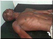 Il faut un montant de 514 000 UM pour opérer Ousmane sow de ses fractures.