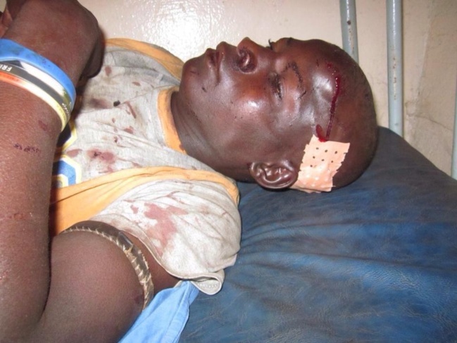 Les images de la barbarie contre les peuls depuis l'arrivée d'alpha condé au pouvoir