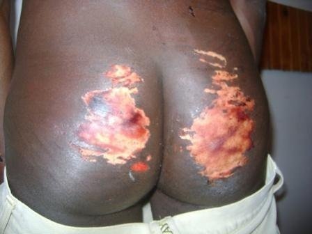 Les images de la barbarie contre les peuls depuis l'arrivée d'alpha condé au pouvoir