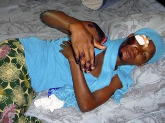 Les images de la barbarie contre les peuls depuis l'arrivée d'alpha condé au pouvoir