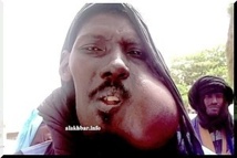 Ould Bamba victime d’un vilain mal : Bienfaiteurs donnez libre à votre générosité