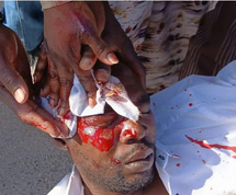 Mauritanie : Esclavage d’une fillette, impunité et coercition Mauritanie : Esclavage d’une fillette, impunité et coercition