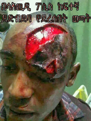 Arrêtez la violence contre Ethiopiens Saudi_Arabia (victimes photo)