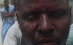 Baba Traoré , le militant de IRA , agressé par des "inconnus"
