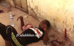 Nouakchott: un jeune, poignardé à la Médina 3
