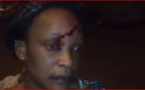 Racisme au Maroc : une congolaise sauvagement battue et blessée. Regardez