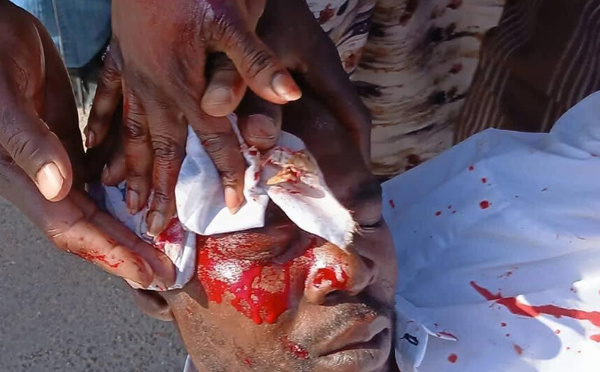 Mauritanie : Esclavage d’une fillette, impunité et coercition